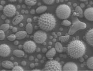 Grains de pollen observés au microscope